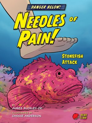 cover image of Needles of Pain!